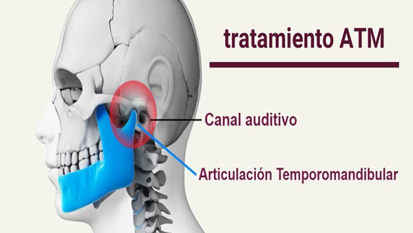 Tractament de l'ATM (articulació tremporomandibular)